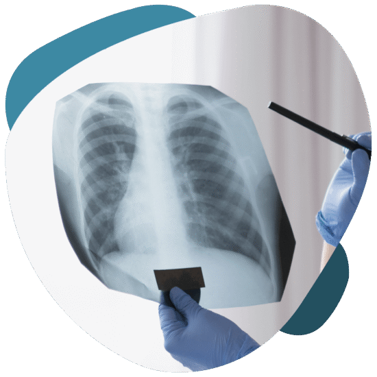 Pulmonology
